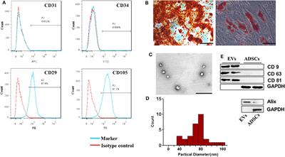 Extracellular Vesicles From Adipose Tissue-Derived Stem Cells Affect Notch-miR148a-3p Axis to Regulate Polarization of Macrophages and Alleviate Sepsis in Mice